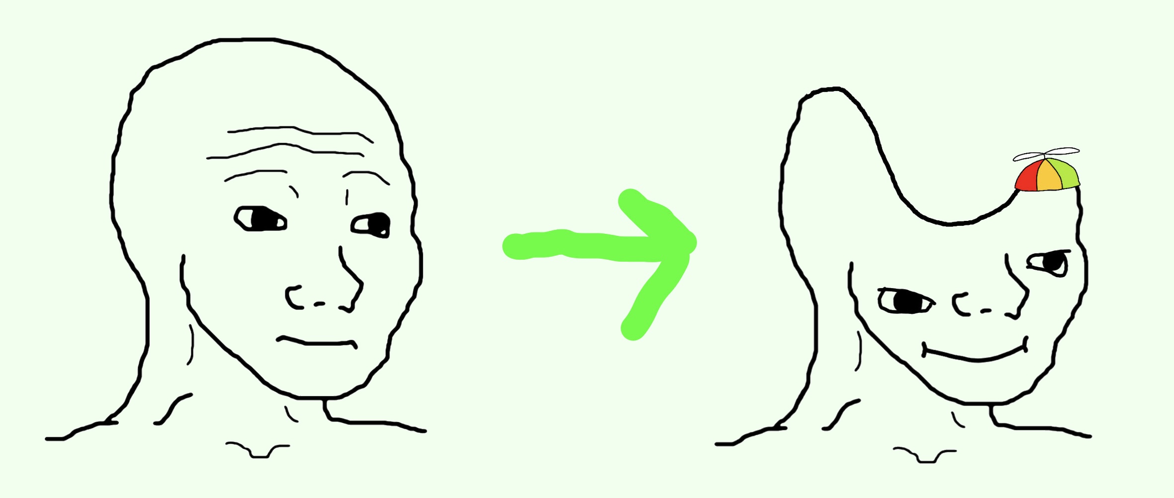 edit